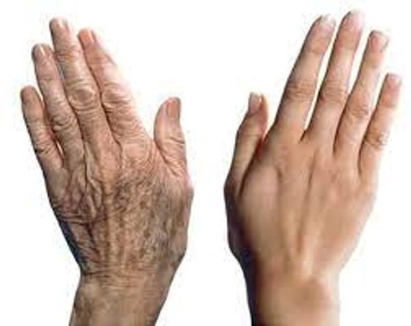 Holistic Solutions For Acne and Aging Skin - Image 7